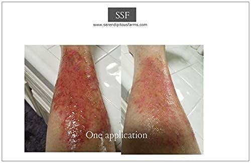 SSF Organics- Comfrey Salve | Concentrated Heal Balm with MSM, Magnesium Oil, Undiluted Comfrey Oil, and Zinc for: Joints | Muscles | Bone | Skin Condtitions | Cysts | Made in the USA. | Clean Company